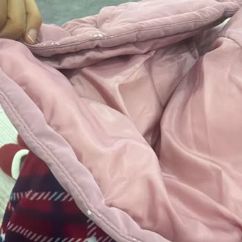 Mango Kids Çocuk Montu 1 Ayda Deri Soyulmuş, Değişim İstiyorum