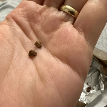 Torku Antep Fıstıklı Çikolatada Sert Yabancı Parça Diş Riski