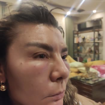 Eki aç