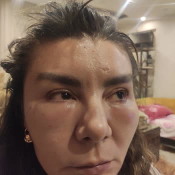 Eki aç