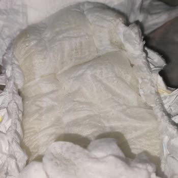 Molfix Bebek Bezinde Sızan Jel Tanecikleri Bebeğimde Şiddetli Pişik Oluşturdu