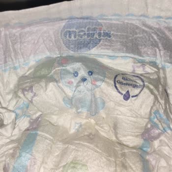 Molfix Bebek Bezinde Sızan Jel Tanecikleri Bebeğimde Şiddetli Pişik Oluşturdu