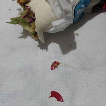 Çiğköfte İçinde Plastik Parça: Komagene Yeşilbayır Şubesinde Sağlık Riski