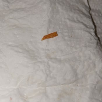 Sucukta Tahta Parçası Bulunması: Sağlık Korkusu Ve Açıklama İsteği