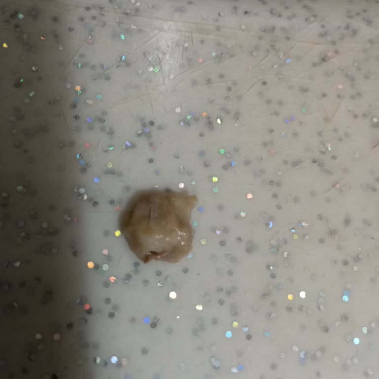 Knorr Kelle Paça Çorbasında Kıl Çıktı, Hijyen İhlali Ve 180 TL İade Talebi