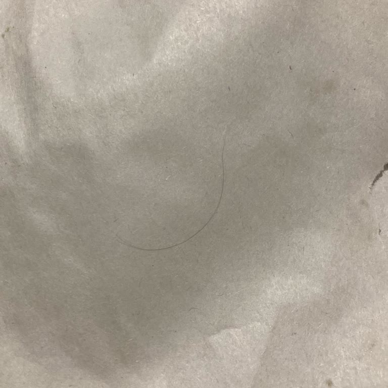 Yemeksepeti Siparişlerinde Hijyen Problemleri Ve Çözüm Sunmayan Müşteri Hizmetleri