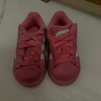 Yeni Aldığım Çocuk LED Ayakkabısında Tek Kullanımda Yünlenme Ve Kirlenme