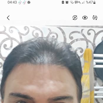 Estecenter Saç Ekimi Sözleşme İhlali Ve Garanti Belgesi Verilmemesi