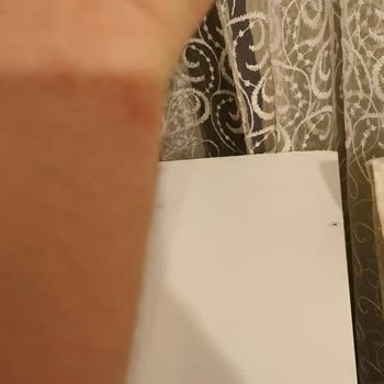 Tecno Gt Akıllı Saat Sorunu