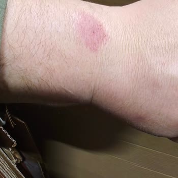 Tecno Gt Akıllı Saat Sorunu