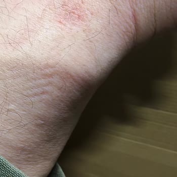 Tecno Gt Akıllı Saat Sorunu