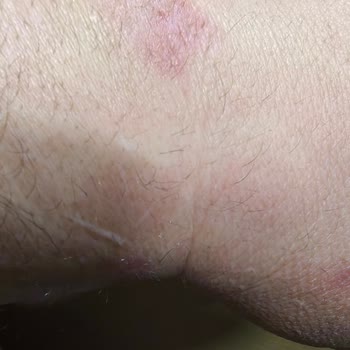 Tecno Gt Akıllı Saat Sorunu