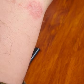 Tecno Gt Akıllı Saat Sorunu