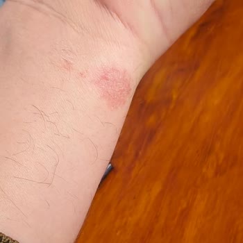 Tecno Gt Akıllı Saat Sorunu