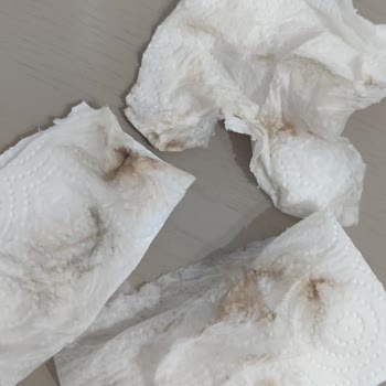 Brita Sebilinde Turuncu Tortu Tekrarı Ve Çocuk Sağlığı Endişesi