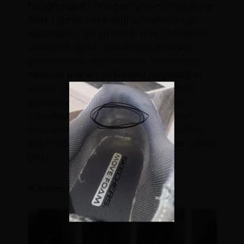 Kısa Sürede Yırtılan Skechers Ayakkabısının Kullanıcı Hatası İddiasına Karşı Değişim Talebi