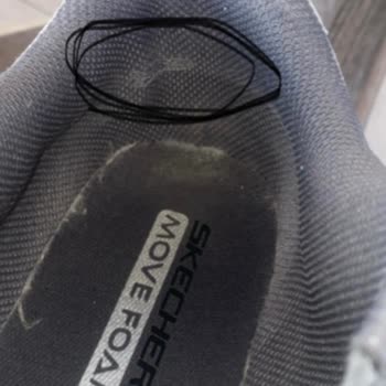 Kısa Sürede Yırtılan Skechers Ayakkabısının Kullanıcı Hatası İddiasına Karşı Değişim Talebi