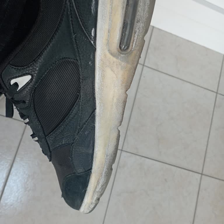 Skechers Ayakkabısındaki Sert Dikiş Parçası Ve Hızlı Çürüyen Tabanı Nedeniyle Yaşanan Mağduriyet