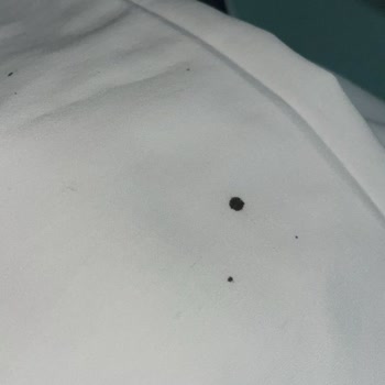 Etkin Olmayan Çözüm Ürünleri Ve Satıcı Sorumluluk Reddi