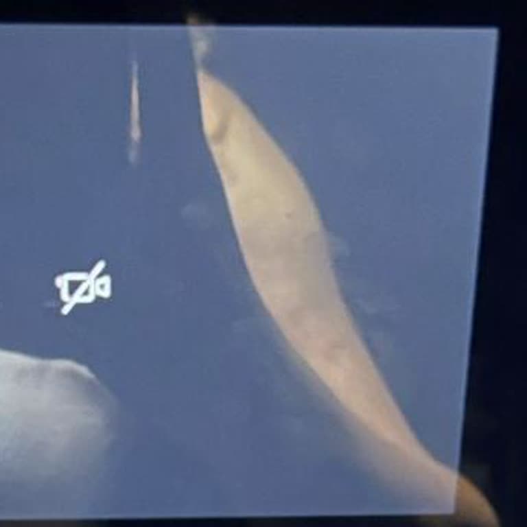 Renault Austral Geri Görüş Kamerası Arızası Ve Parça Bekleyişi