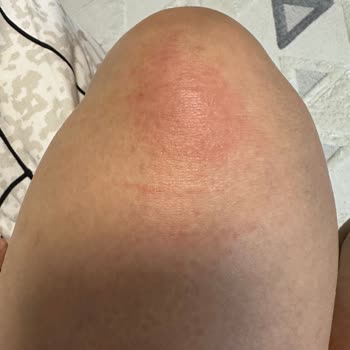 Reway Club Soğuk Hamam, Hijyen İhlali Ve Kötü Hizmet!