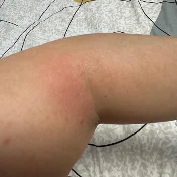 Reway Club Soğuk Hamam, Hijyen İhlali Ve Kötü Hizmet!