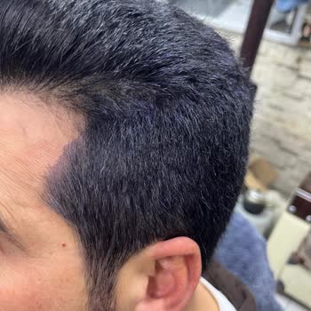 Sea Color Siyah Saç Boyasıyla Ciddi Bir Sorun Yaşıyorum