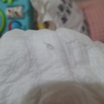 Molfix Premium 5 Numaralı Bebek Bezinde Sert Parçalar Ve Cilt Tahrişi