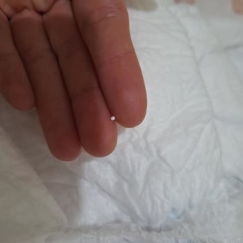 Molfix Premium 5 Numaralı Bebek Bezinde Sert Parçalar Ve Cilt Tahrişi