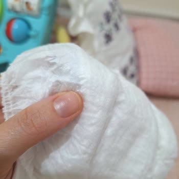 Molfix Premium 5 Numaralı Bebek Bezinde Sert Parçalar Ve Cilt Tahrişi