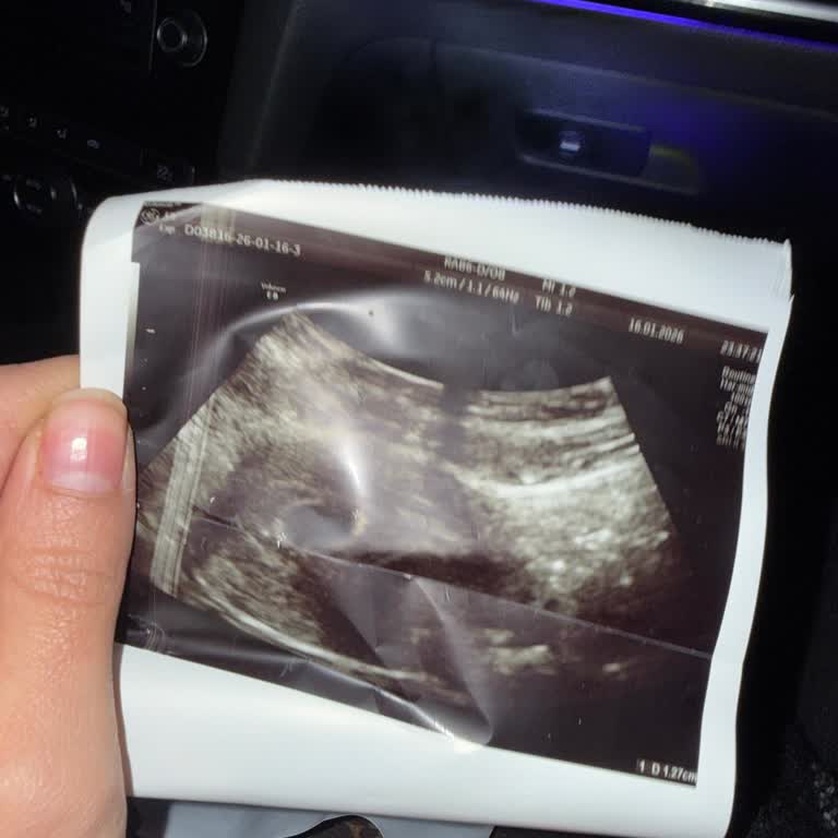 Gebelik Kesesi Çelişkili Bilgilendirme Ve Duygusal İhmal