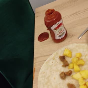 Burcu Gıda Patlayan Ketçap Gözümde Kalıcı Hasara Neden Oldu, Şirket Destek Vermedi