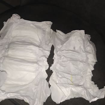 Sleepy Bebek Bezinde Bozuk Ürün Ve Yetersiz Telafi!