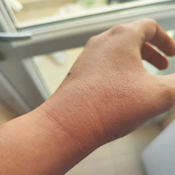 Hoover Bulaşık Makinesinde Su Dolu, Servis Gecikmesi Ve Sağlık Sorunu