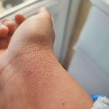 Hoover Bulaşık Makinesinde Su Dolu, Servis Gecikmesi Ve Sağlık Sorunu