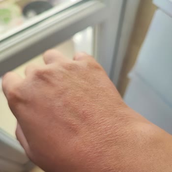 Hoover Bulaşık Makinesinde Su Dolu, Servis Gecikmesi Ve Sağlık Sorunu