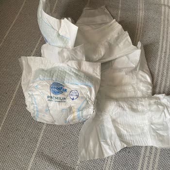 Molfix Bebek Bezinde Yapıştırma Şeridi Kopukluğu Ve Bebeğin Sağlığı Riski