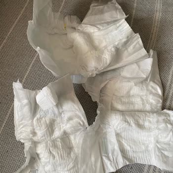 Molfix Bebek Bezinde Yapıştırma Şeridi Kopukluğu Ve Bebeğin Sağlığı Riski