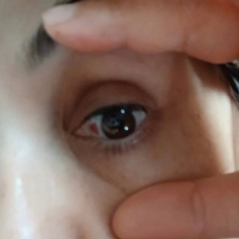 Bioderma Göz Kremi Kullanım Sonrası Göz Çevresi Kararması Ve Şikayetvar’da Benzer Şikayetler