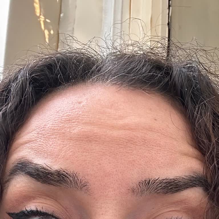 Liva Clinic (Bakırköy)’te Botoks İlacının Yanlış Saklanması Yüzde Yaşlanma Ve Şişlik Yarattı