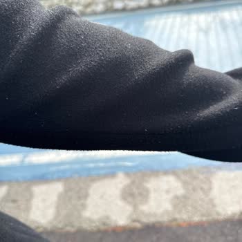 Koton Kaşe Kabanı 1 Yılda Tüylenme Ve Doku Bozukluğu