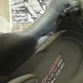 Skechers Ayakkabısının Kısa Sürede Topuk Yırtılması Ve Garanti Reddi