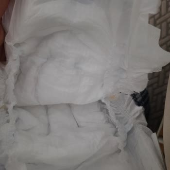 Molfix Bebek Bezinde Dolgu Dökülmesi Ve Sertlik Sorunu