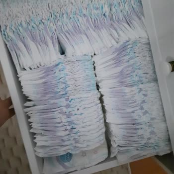 Molfix Bebek Bezinde Dolgu Dökülmesi Ve Sertlik Sorunu