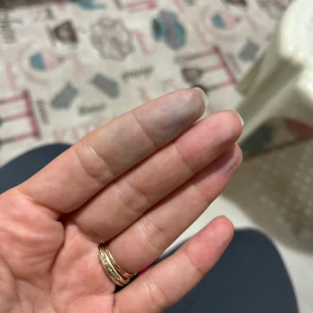 Procsin Copper Whitening Mask'te Mavi Boya Ve Cilt Tahrişi