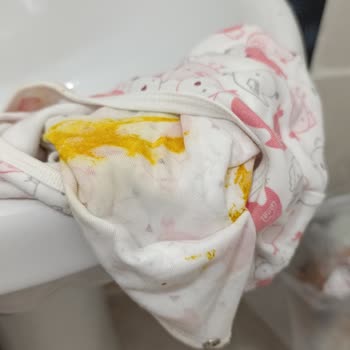 Prima Premium Care Bezlerde Sürekli Sızdırma Sorunu Ve Mağduriyet