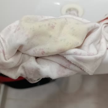 Prima Premium Care Bezlerde Sürekli Sızdırma Sorunu Ve Mağduriyet