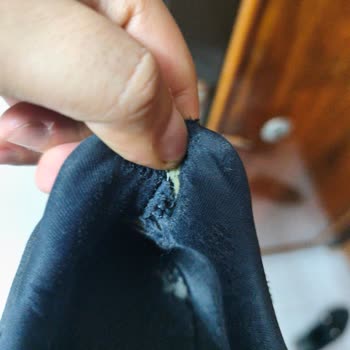 Fahiş Fiyatlara Satılan Skechers Ayakkabıda Kısa Sürede Açılmalar Ve Mağaza Desteği Yok