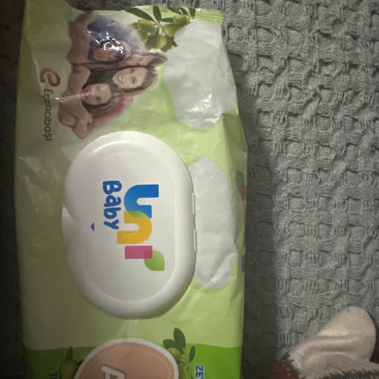 Uni Baby Zeytinyağlı Islak Mendilde Şiddetli Yanma Ve Cilt Tahrişi