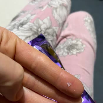 Eti Gong Paketi İçinde Sert Cam Parçalar: Sağlık Riski Ve Güven Kaybı